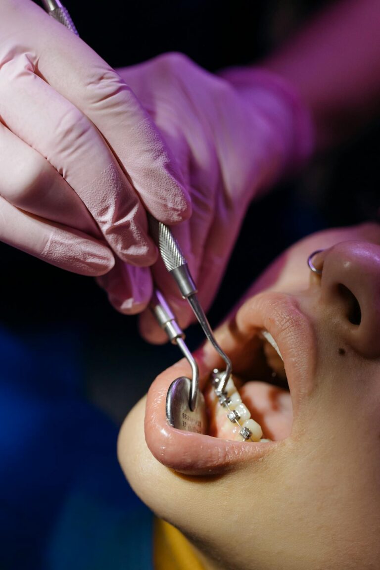 Close-up view of a dental examination focusing on braces treatment.
